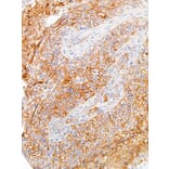 Immunohistochemistry - Anti-PD-L1 Antibody [IHC411] (A86904) - Antibodies.com