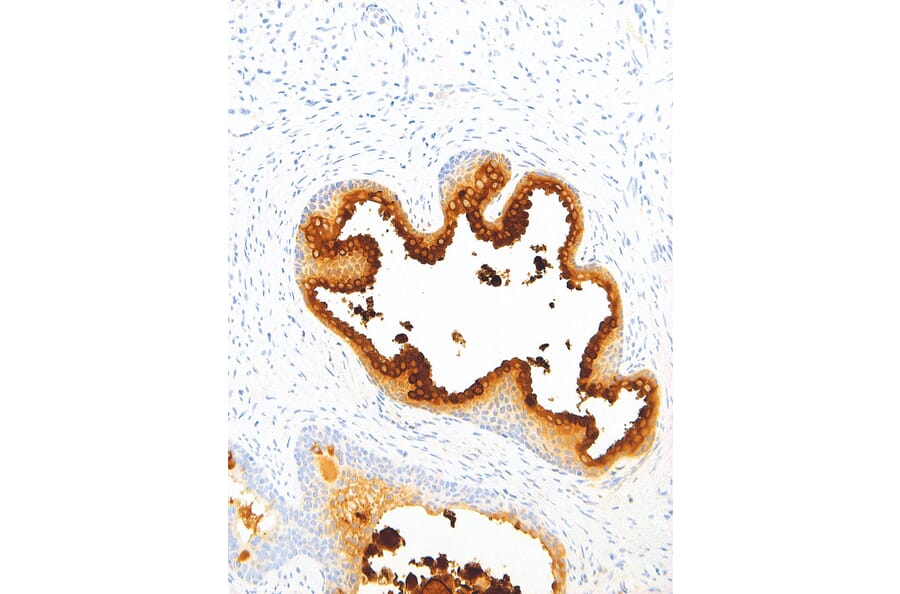 Immunohistochemistry - Anti-Prostate Specific Antigen Antibody [IHC654] (A86905) - Antibodies.com