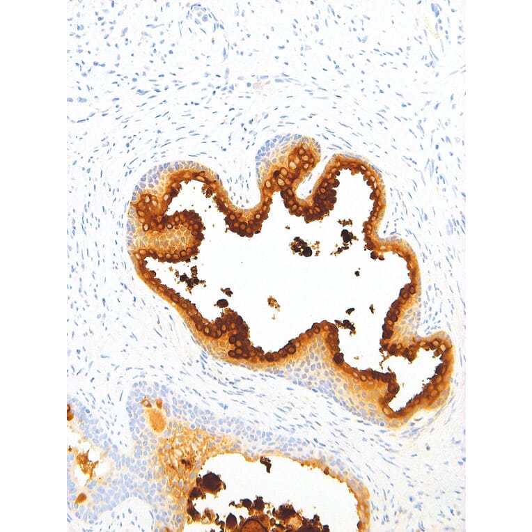 Immunohistochemistry - Anti-Prostate Specific Antigen Antibody [IHC654] (A86905) - Antibodies.com