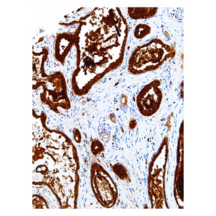 Immunohistochemistry - Anti-PSAP Antibody [IHC655] (A86906) - Antibodies.com