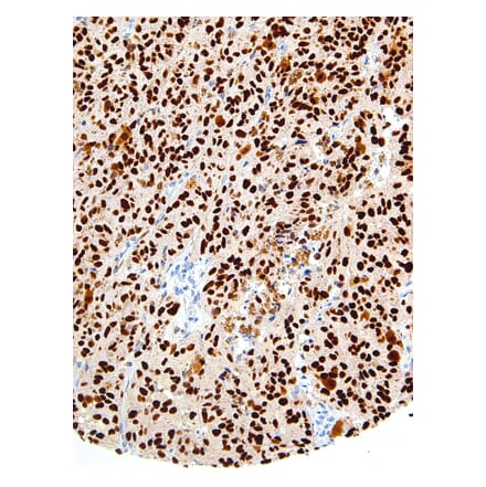 Immunohistochemistry - Anti-SOX10 Antibody [IHC010] (A86907) - Antibodies.com