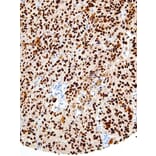Immunohistochemistry - Anti-SOX10 Antibody [IHC010] (A86907) - Antibodies.com