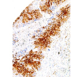 Immunohistochemistry - Anti-TAG-72 Antibody [IHC072] (A86908) - Antibodies.com