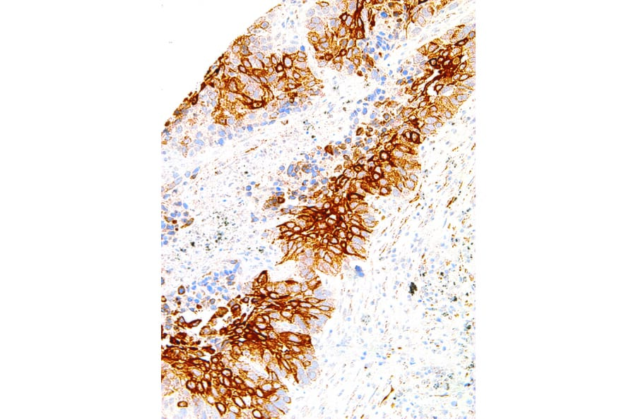 Immunohistochemistry - Anti-TAG-72 Antibody [IHC072] (A86908) - Antibodies.com