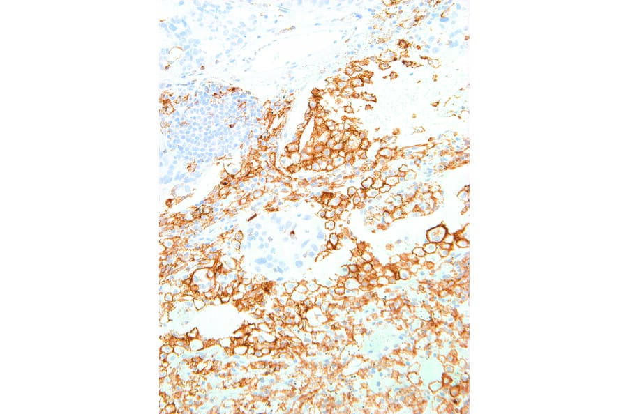 Immunohistochemistry - Anti-TIM 3 Antibody [IHC003] (A86909) - Antibodies.com