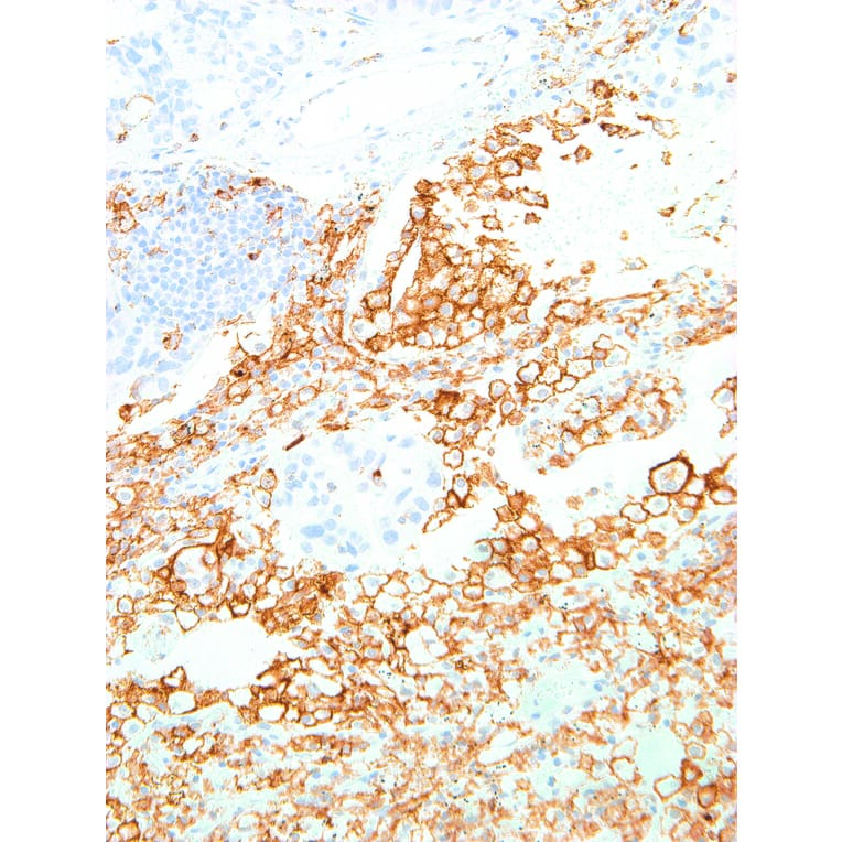 Immunohistochemistry - Anti-TIM 3 Antibody [IHC003] (A86909) - Antibodies.com