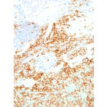 Immunohistochemistry - Anti-TIM 3 Antibody [IHC003] (A86909) - Antibodies.com