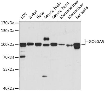 Western blot analysis of extracts of various cell lines, using Anti-GOLGA5 Antibody (A15768) at 1:1,000 dilution.
Secondary antibody: Goat Anti-Rabbit IgG (H+L) (HRP) (AS014) at 1:10,000 dilution.
Lysates / proteins: 25µg per lane.
Blocking buffer: 3% non-fat dry milk in TBST.
Detection: ECL Basic Kit (RM00020).
Exposure time: 60s.