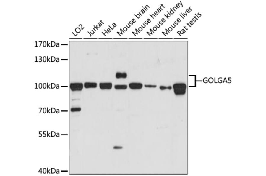Western Blot - Anti-GOLGA5/Golgin-84 Antibody (A87549) - Antibodies.com