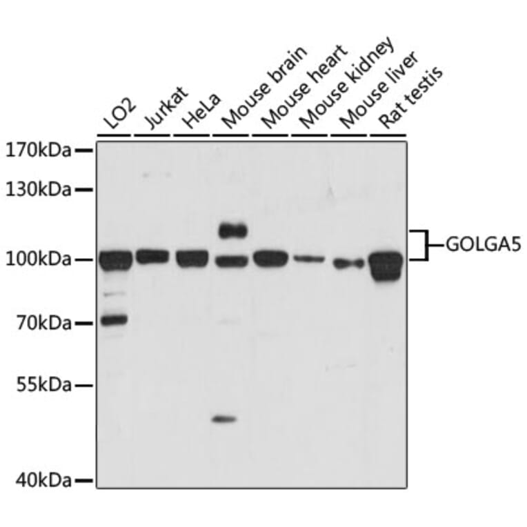 Western Blot - Anti-GOLGA5/Golgin-84 Antibody (A87549) - Antibodies.com