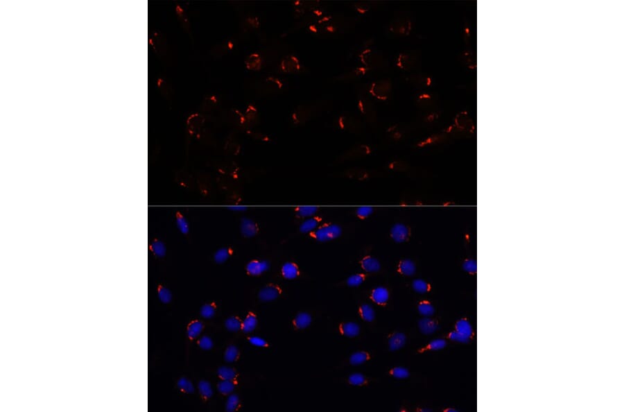 Immunofluorescence - Anti-GOLGA5/Golgin-84 Antibody (A87549) - Antibodies.com