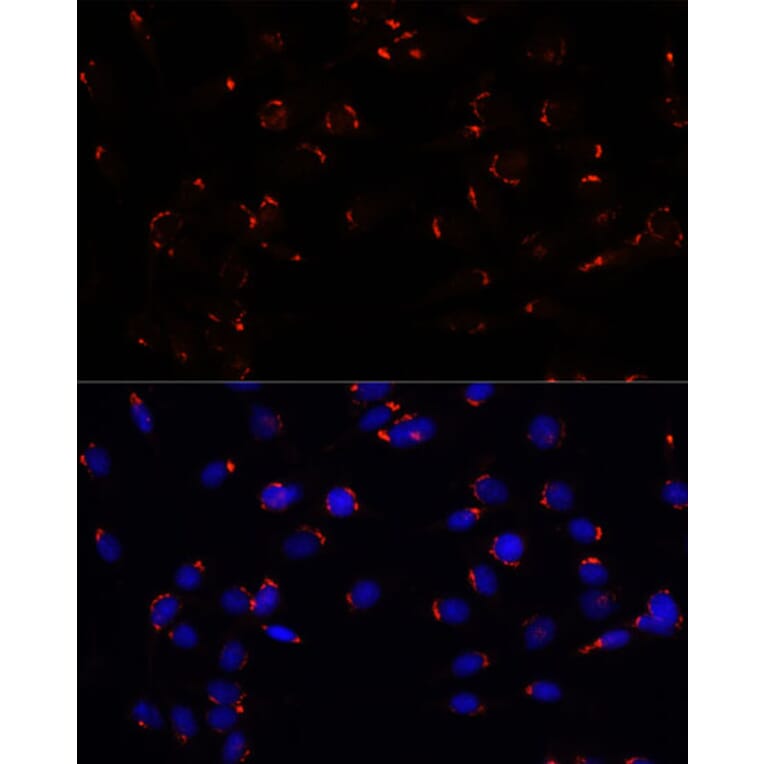 Immunofluorescence - Anti-GOLGA5/Golgin-84 Antibody (A87549) - Antibodies.com