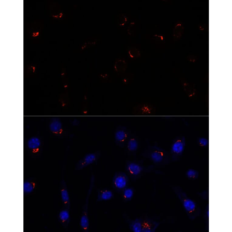 Immunofluorescence - Anti-GOLGA5/Golgin-84 Antibody (A87549) - Antibodies.com