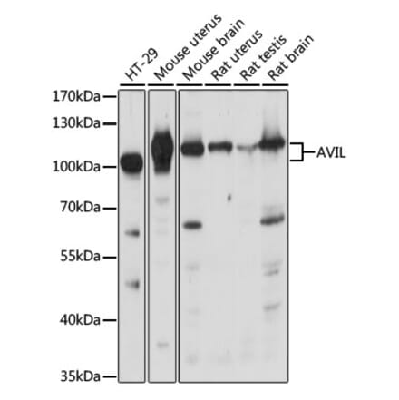 Western Blot - Anti-p92 Antibody (A87550) - Antibodies.com