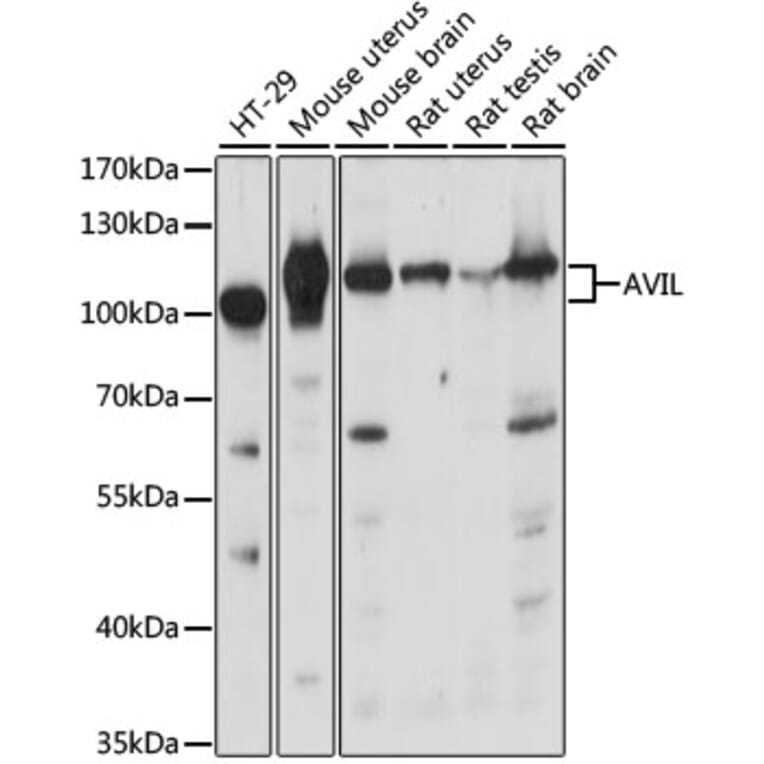 Western Blot - Anti-p92 Antibody (A87550) - Antibodies.com