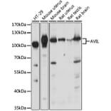 Western Blot - Anti-p92 Antibody (A87550) - Antibodies.com