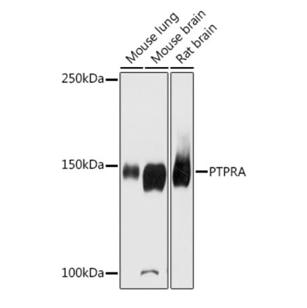 Western Blot - Anti-PTP alpha Antibody (A87551) - Antibodies.com