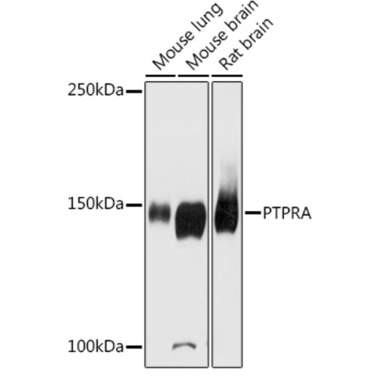 Western Blot - Anti-PTP alpha Antibody (A87551) - Antibodies.com