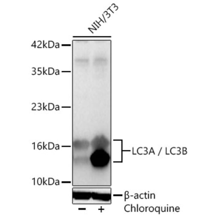 Western Blot - Anti-LC3B Antibody (A87552) - Antibodies.com
