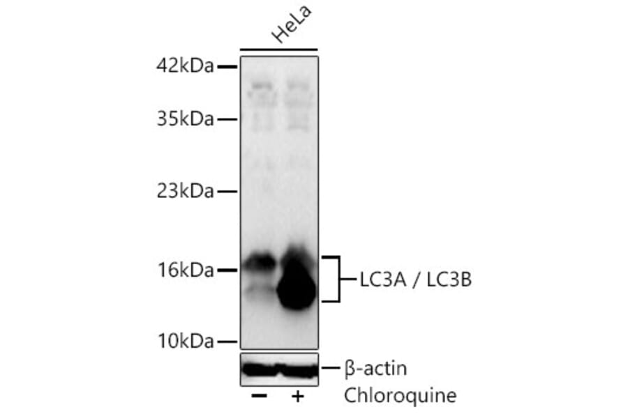 Western Blot - Anti-LC3B Antibody (A87552) - Antibodies.com