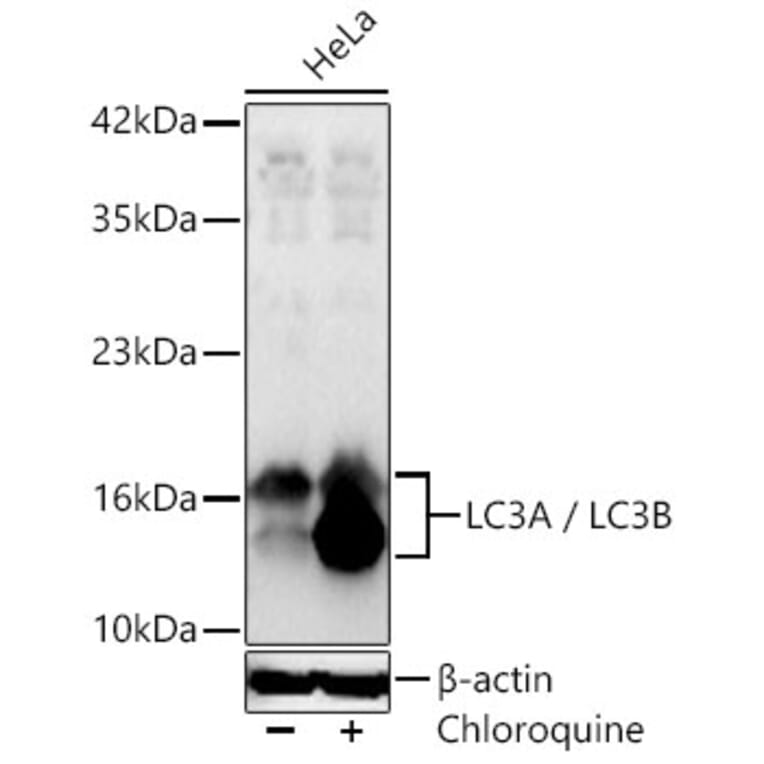 Western Blot - Anti-LC3B Antibody (A87552) - Antibodies.com