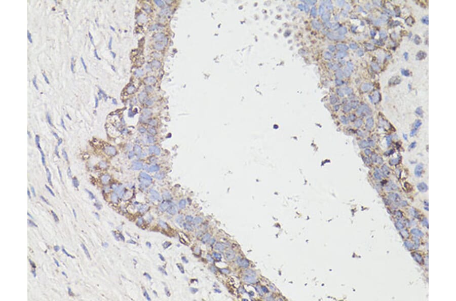 Immunohistochemistry - Anti-LC3B Antibody (A87552) - Antibodies.com