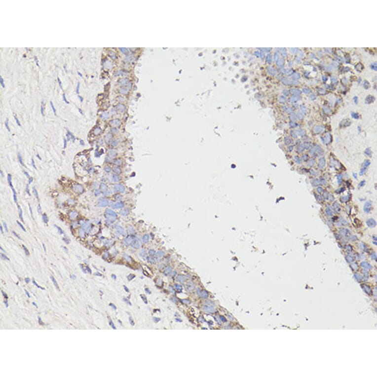 Immunohistochemistry - Anti-LC3B Antibody (A87552) - Antibodies.com