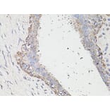 Immunohistochemistry - Anti-LC3B Antibody (A87552) - Antibodies.com