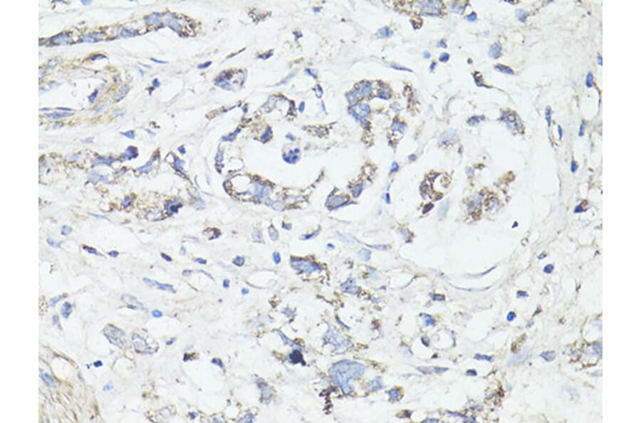 Immunohistochemistry - Anti-LC3B Antibody (A87552) - Antibodies.com