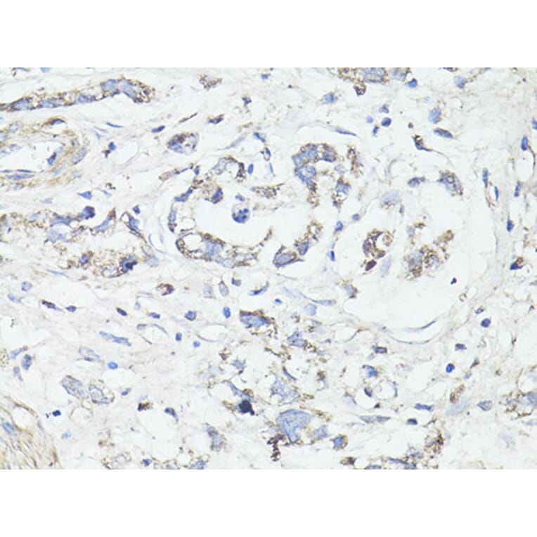 Immunohistochemistry - Anti-LC3B Antibody (A87552) - Antibodies.com