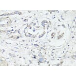 Immunohistochemistry - Anti-LC3B Antibody (A87552) - Antibodies.com