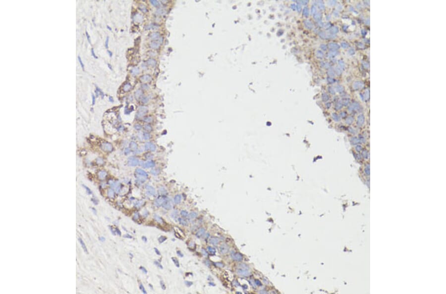 Immunohistochemistry - Anti-LC3B Antibody (A87552) - Antibodies.com