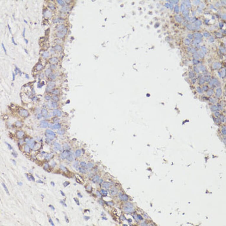 Immunohistochemistry - Anti-LC3B Antibody (A87552) - Antibodies.com