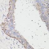 Immunohistochemistry - Anti-LC3B Antibody (A87552) - Antibodies.com