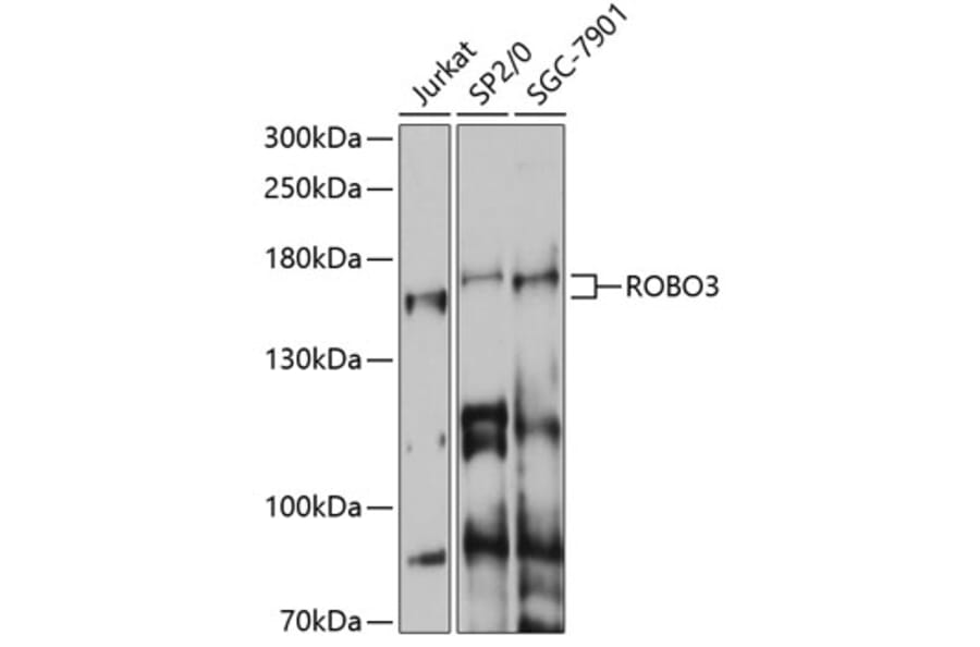 Western Blot - Anti-Robo3 Antibody (A87553) - Antibodies.com