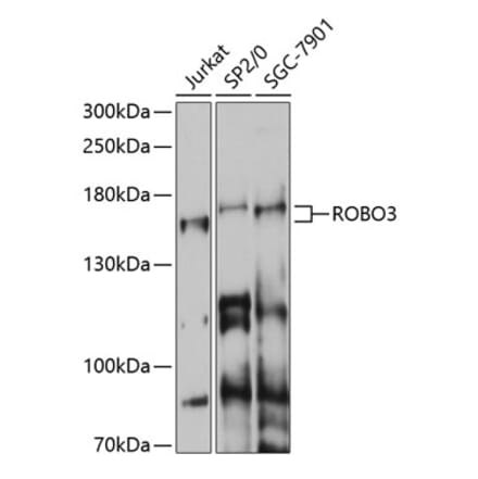 Western Blot - Anti-Robo3 Antibody (A87553) - Antibodies.com