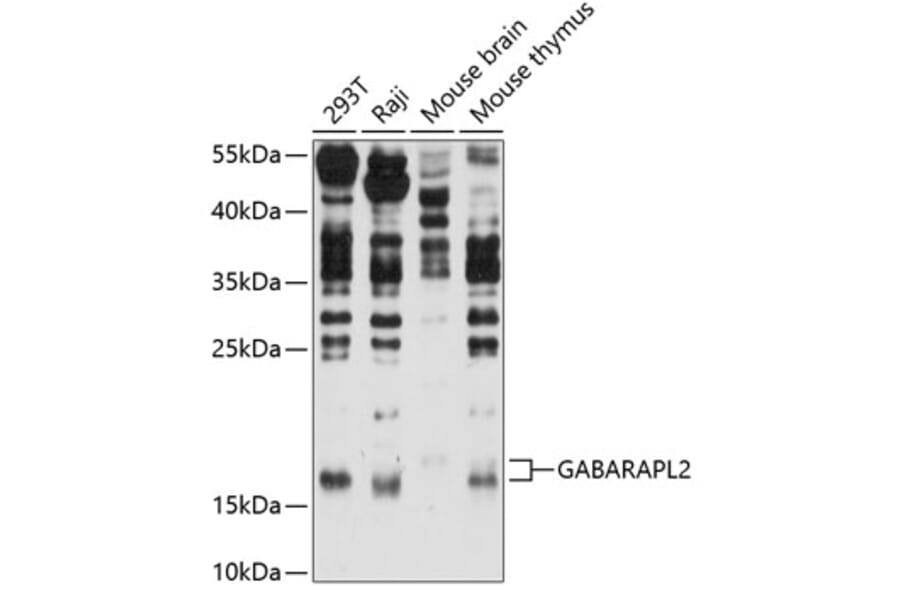 Western Blot - Anti-GABARAPL2/GATE-16 Antibody (A87554) - Antibodies.com