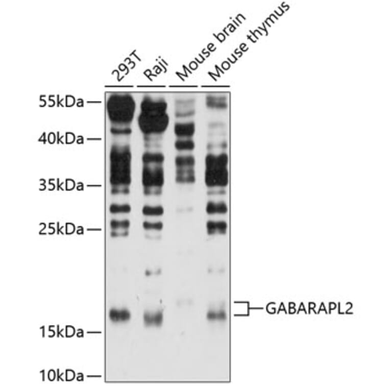 Western Blot - Anti-GABARAPL2 / GATE-16 Antibody (A87554) - Antibodies.com