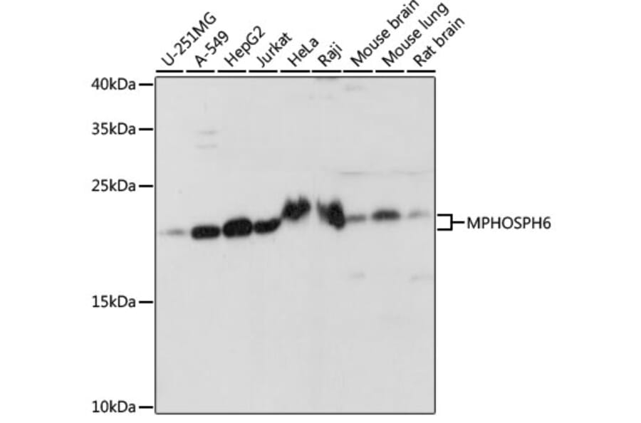 Western Blot - Anti-MMP6/MPP6 Antibody (A87555) - Antibodies.com