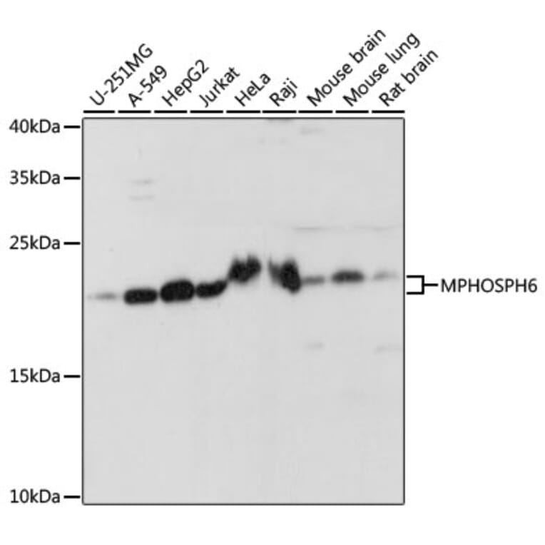 Western Blot - Anti-MMP6 / MPP6 Antibody (A87555) - Antibodies.com