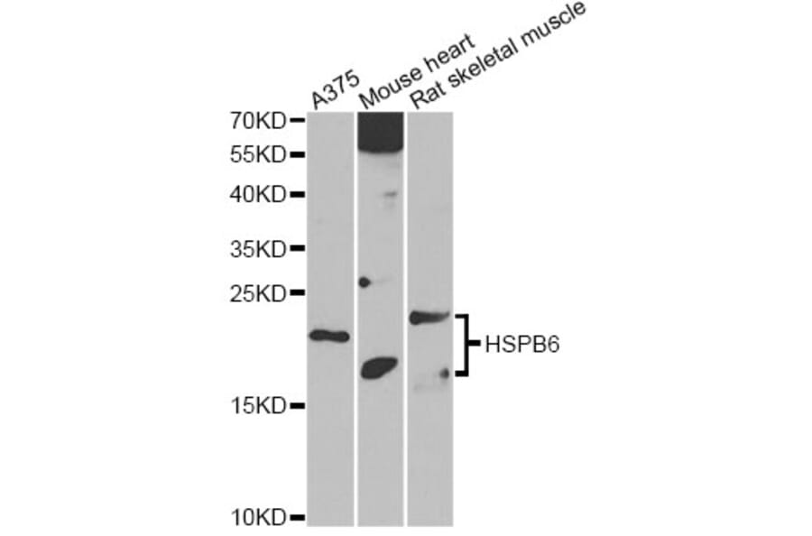 Western Blot - Anti-HSPB6 Antibody (A14158) - Antibodies.com