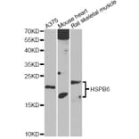 Western Blot - Anti-HSPB6 Antibody (A14158) - Antibodies.com