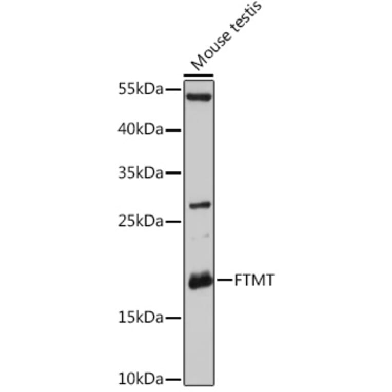 Western Blot - Anti-Mitochondrial Ferritin Antibody (A87557) - Antibodies.com