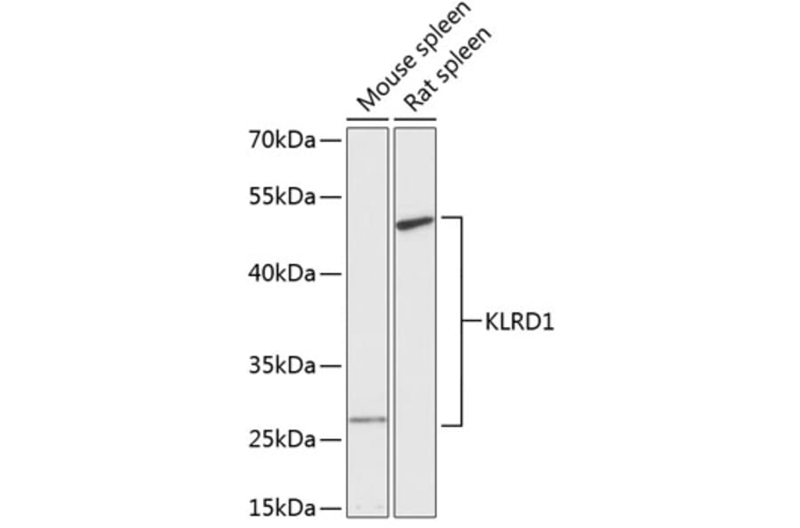 Western Blot - Anti-CD94 Antibody (A87558) - Antibodies.com