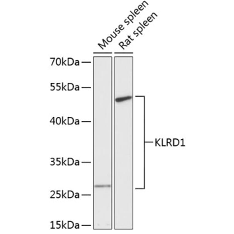 Western Blot - Anti-CD94 Antibody (A87558) - Antibodies.com