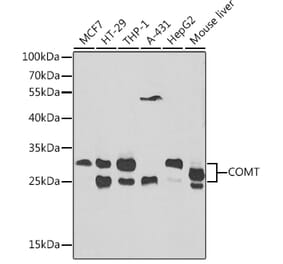 Western Blot - Anti-COMT Antibody (A87559) - Antibodies.com