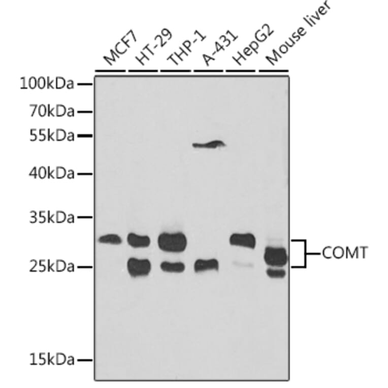 Western Blot - Anti-COMT Antibody (A87559) - Antibodies.com