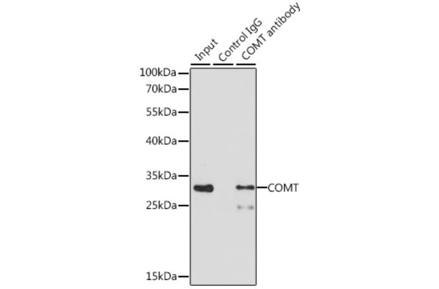 Western Blot - Anti-COMT Antibody (A87559) - Antibodies.com