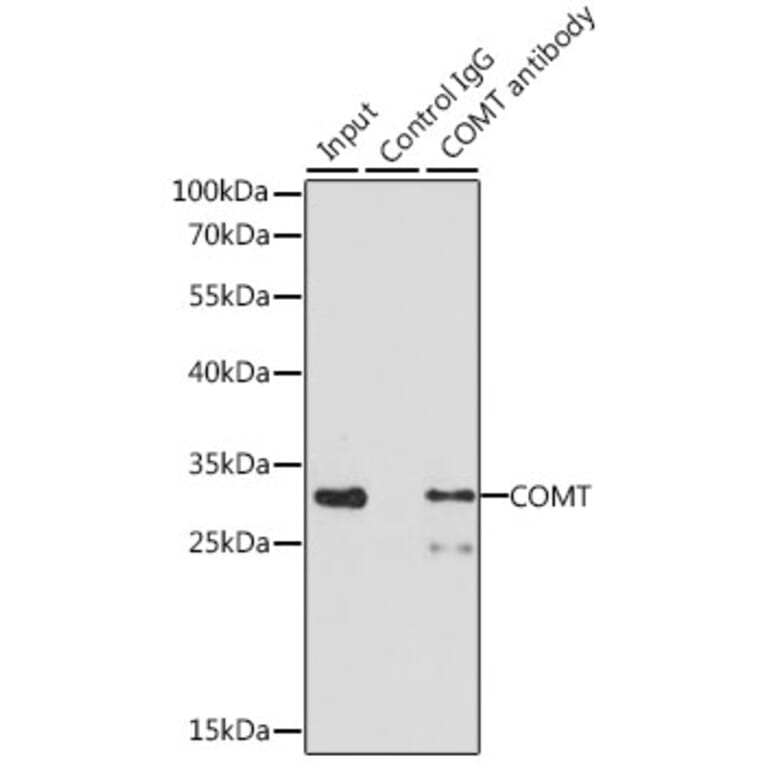 Western Blot - Anti-COMT Antibody (A87559) - Antibodies.com