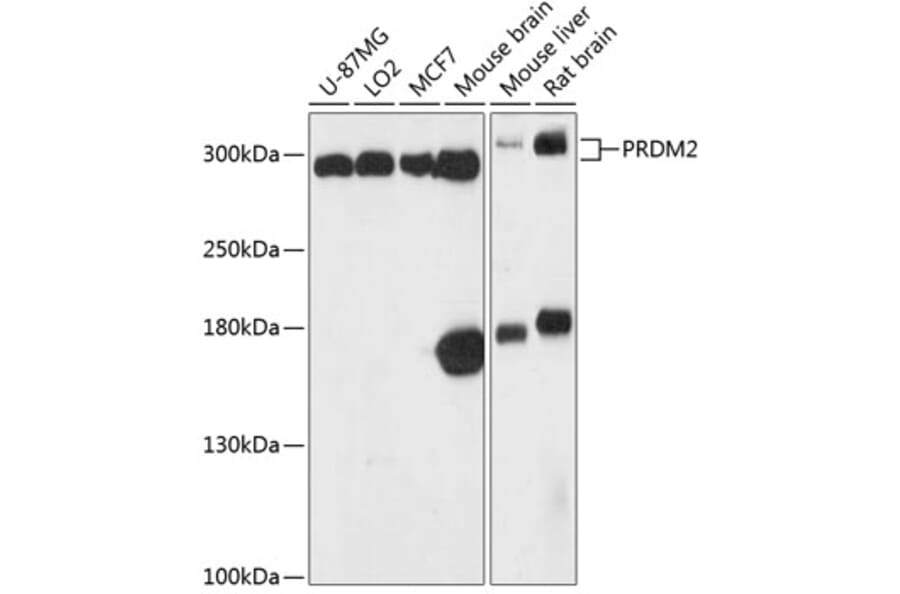Western Blot - Anti-RIZ1 Antibody (A87560) - Antibodies.com